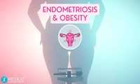 اندومتریوز و چاقی: بررسی تعاملات هورمونی، التهابی و بالینی